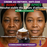 Moins de rides, plus d’éclat : révélez la jeunesse de votre peau